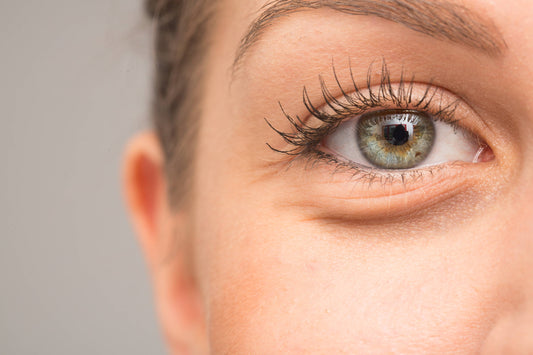 Under-Eye Bags: The Main Cause & 21 Ways To Get Rid of Them (Naturally)